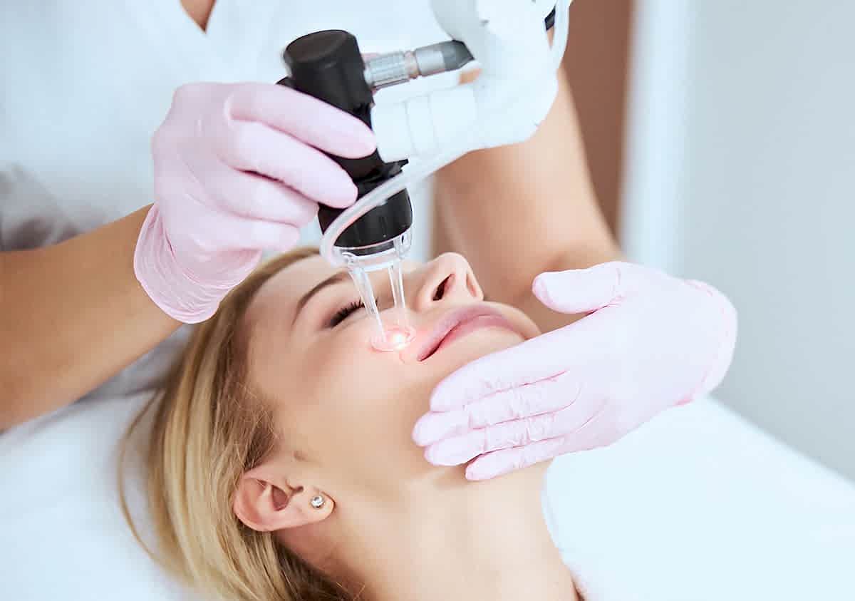 FRAKSİYONEL KARBONDİOKSİT LAZER