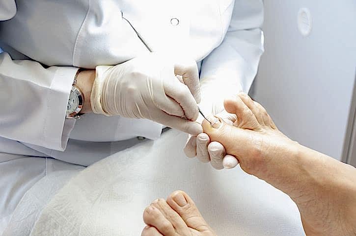 TIRNAK TELİ (ONİKOTEL)