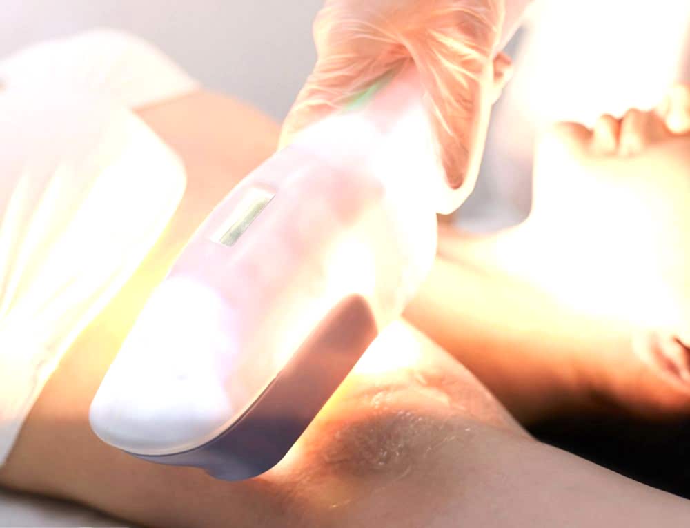 LAZER EPİLASYONDA KULLANILAN IŞIK SİSTEMLERİ