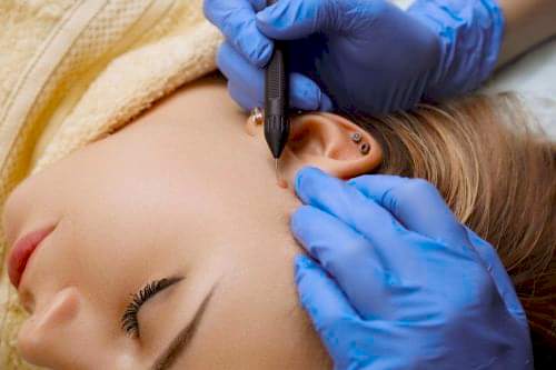 ELEKTRO KOTERİZASYON