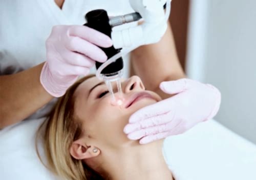 FRAKSİYONEL KARBONDİOKSİT LAZER