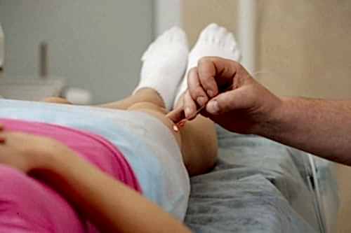 LAZER İLE KILCAL DAMAR TEDAVİSİ