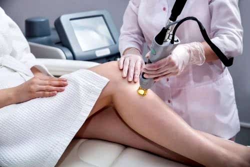 LAZER İLE TÜY SARARTMA