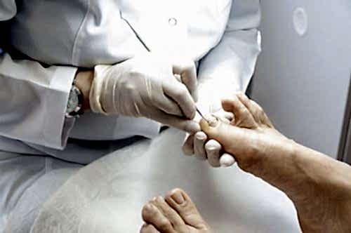 TIRNAK TELİ (ONİKOTEL)