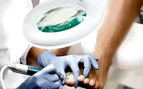 MEDİKAL AYAK BAKIMI